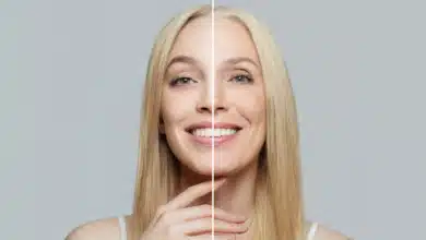 Alterungsprozess