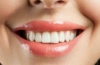 Weiße Zähne